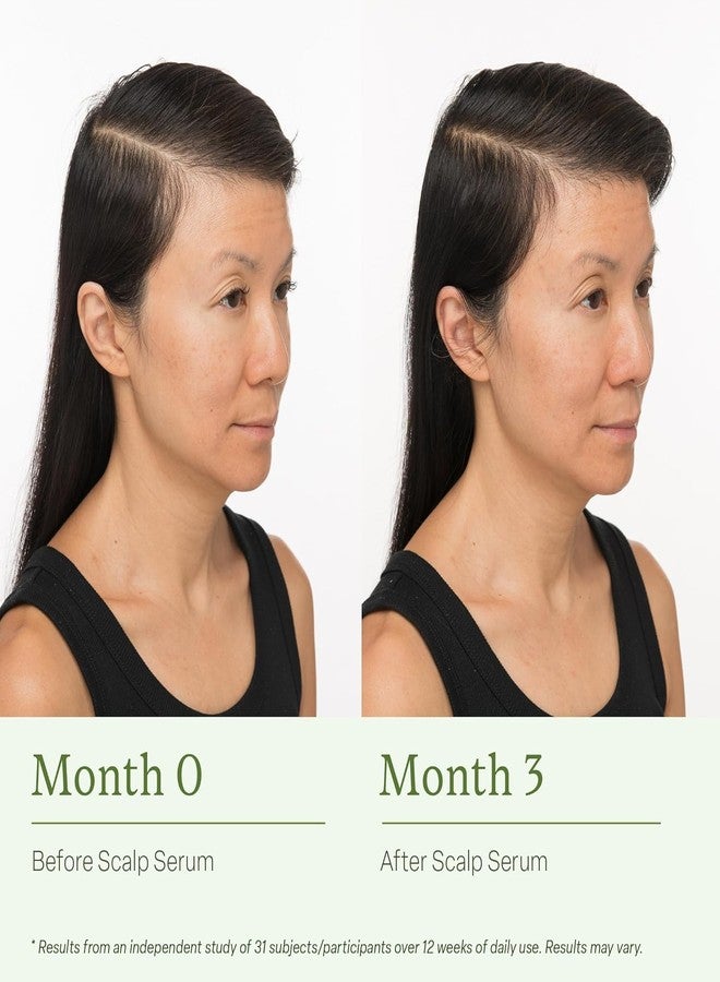 Divi Scalp Serum for Thinning Hair, 30ml – Clinically Tested, Nourishing Formula with Amino Acids, Caffeine & Rosemary Oil – Promotes Healthy Scalp, Reduces Oil & Product Buildup, Pack of 2 - Image 5